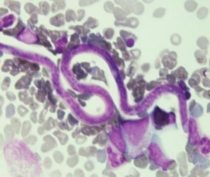 Figure 2: Sheathed microfilaria 100x