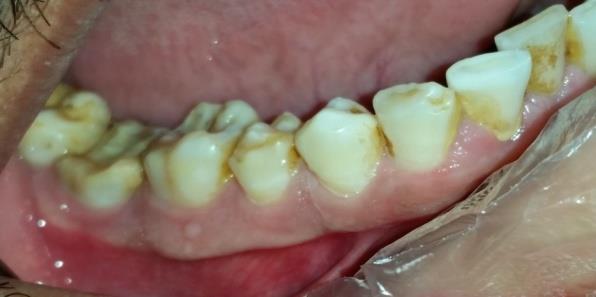 Figure 9: Follow-up visit: (1month).