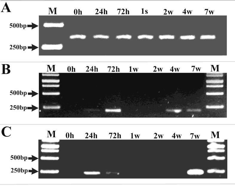 Figure 3: Photos of agarose gel (1%) showing the expression patterns of EsActin1 (A), EsWnt1 (B) and EsWnt4 (C) genes during the stages 0, 24, 72 hour (s), 1, 2, 4 and 7 week (s) post-amputation. M: DNA Ladder marker.