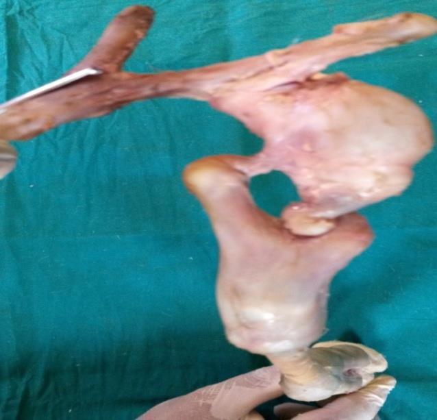 Figure 4: Growth anatomy of the limb: The femur attached tightly to the pelvic bone at the acetabulum. All joints were tightly fixed.