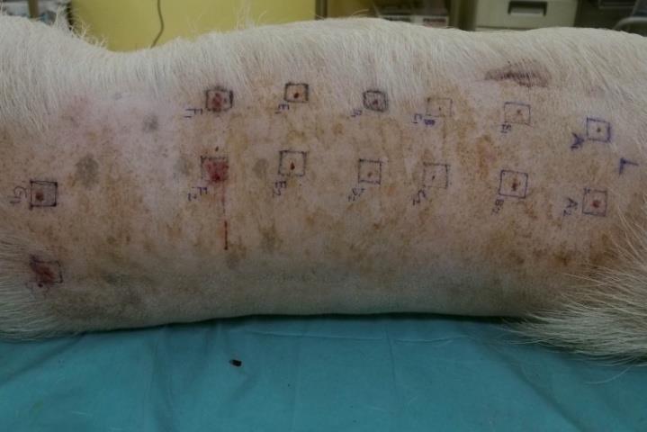 Figure 1: The respective ingredients in injections for zones A-G were: A: 3cc fanning injection of autologous fat B: 3cc bolus injection of autologous fat C: 3cc injection of PLLA only D: 3cc injection of mixed PLLA and autologous fat E: 3cc injection of hyaluronic acid 1cc only F: 3cc injection of mixed hyaluronic acid 1cc with autologous fat 3cc G: botulinum toxin injection of 10u in each corner of zone G and then 3cc bolus injection of autologous fat in the center After surgery recovering from anesthesia, the pig lived normally for three months and then euthanasia was performed. The specimen was fixed in formalin for biopsy and stained with the hematoxylin and eosin (H&E). The histological changes were analyzed.