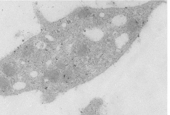 Figure 4: Disappearance of granules.