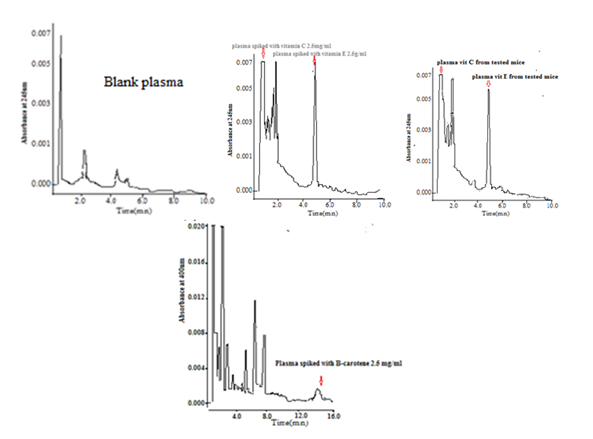 Figure 3: Determination of vitamins in plasma by HPLC in different studied groups.