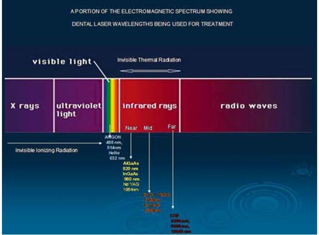 Figure 2: Light spectrum showing the available dental laser wavelengths.