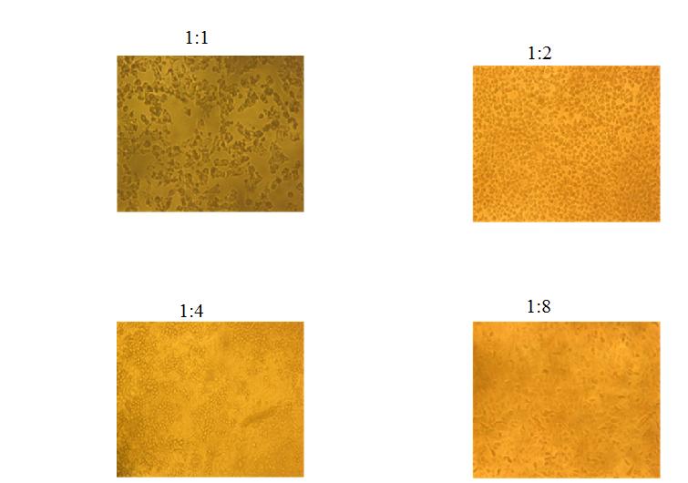 Figure 1: DPPH analysis of secondary metabolites extract from _E. profundum_ BC2-11.