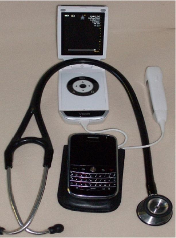 Figure 1: GE V-Scan (weight 390 g, General Electric, Milwaukee, WI, USA) with fixed sector angle of 75º and a 1.7- 3.8MHz transducer.