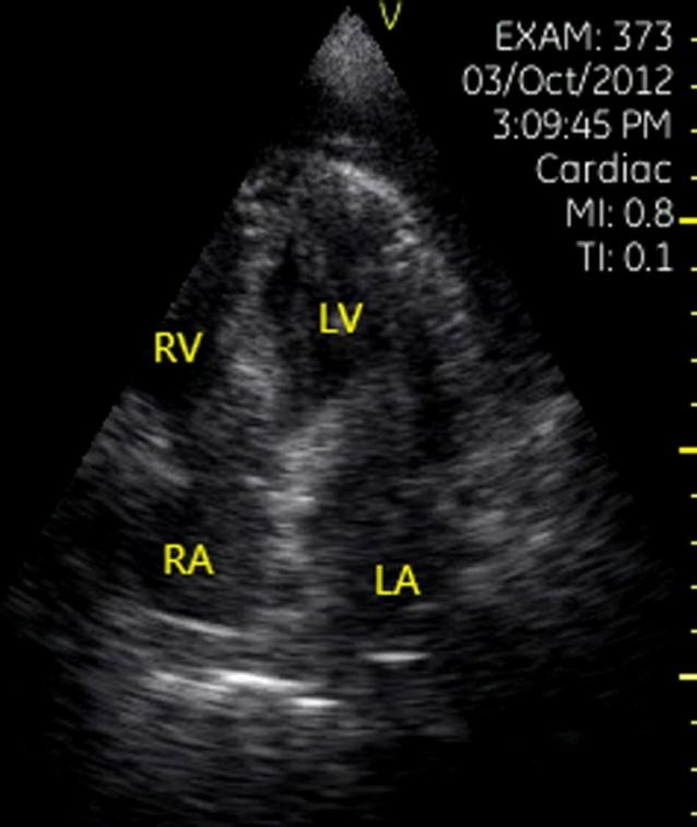 Figure 13