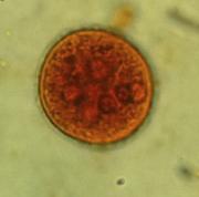 Figure 1: Entamoeba coli, cyst stage, stained with iodine.