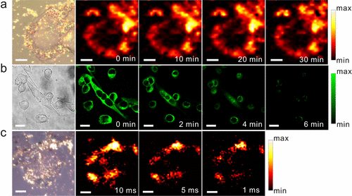 Figure 4: These features of MSNs are favorable for long-term, high-speed, and real-time bioimaging under the continuous laser irradiation. The combination of MSNs, Fe3O4, and Au has been proposed for near-infrared biomedical applications [56].