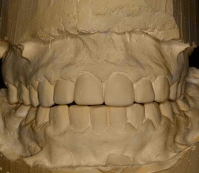 Figure 4: Mounted study model.