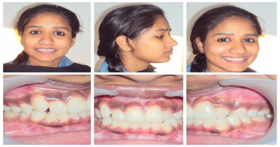 Figure 1: Pre treatment photographs.
