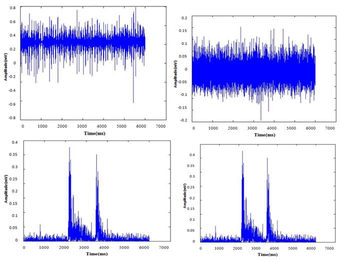Figure 4: EMG signal analysis of manual lifting of an employee.