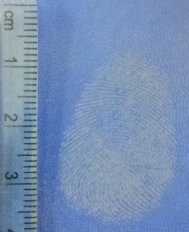 Figure 4: Development of latent fingerprints on Iron surface.