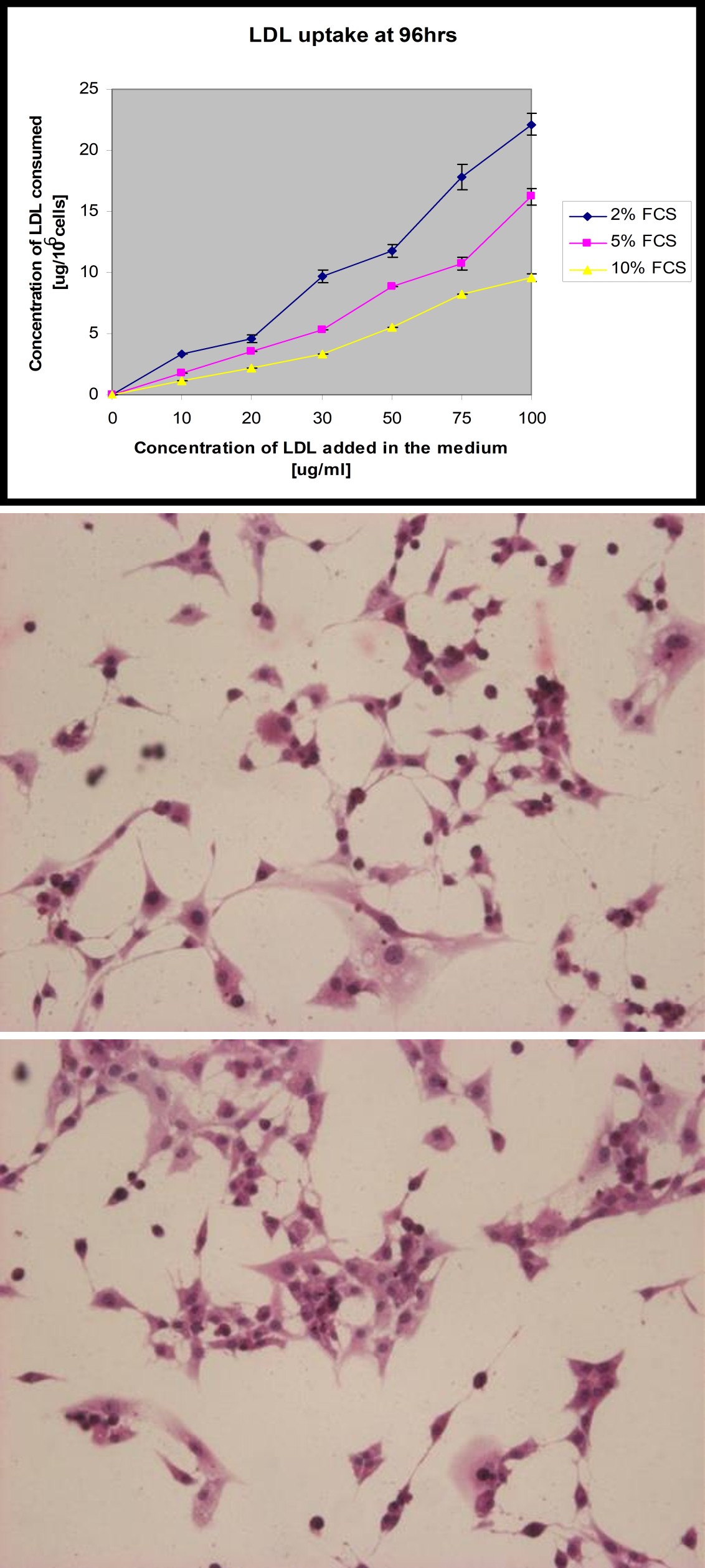 Figure 3: Cell morphology at various serum concentrations [with and without LDL] after 48hrs incubation. The decrease of serum concentration from 10% to 2% and addition of LDL in the culture medium did not make any change in the cell morphology