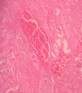 Figure 4: Kidney normal tubules and glomeruliin