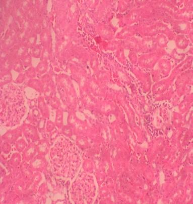Figure 8: Normal glomeruli and kidney tubules in rats treated with L-ascorbic acid (H&E 100X)