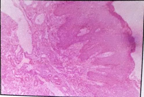 Figure 6: Histopathology.
