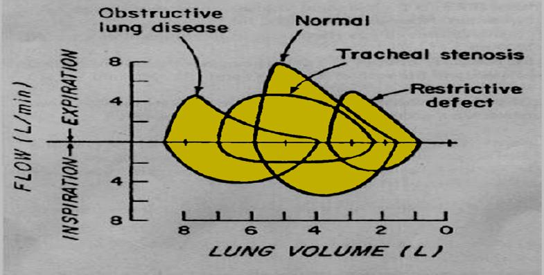 Figure 9: Flow Volume loop.