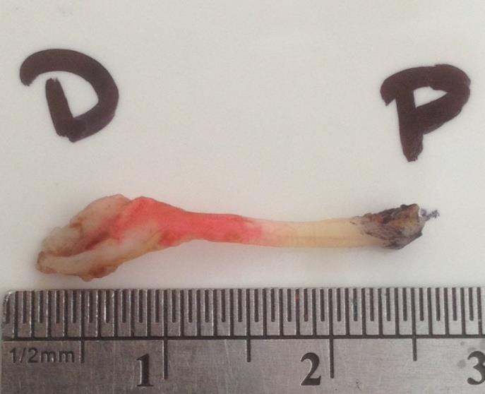 Figure 1: Measurement and marking of the proximal and distal ends of the nerve explants obtained.
