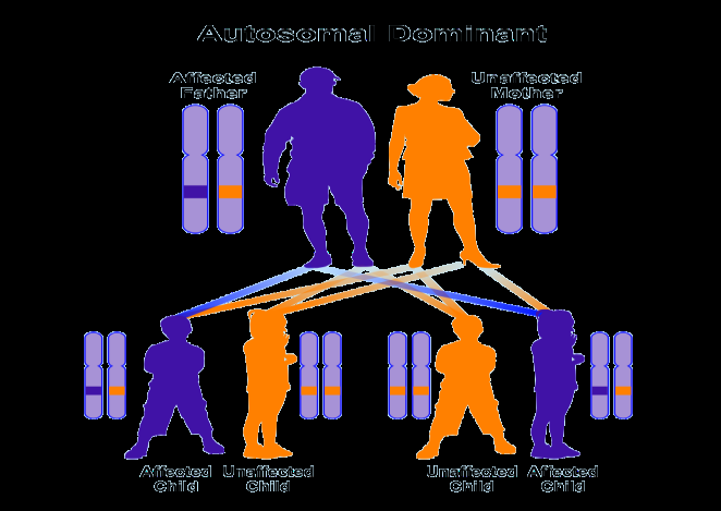 Figure 3: Schematic representation of the dominant autosomal inheritance pattern that Adult-onset Leukoencephalopathy with Axonal Spheroids and Pigmented Glia Syndrome follows from this pattern.