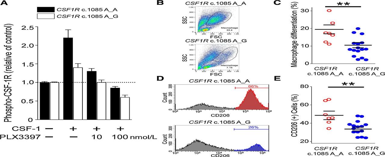 Figure 6: Schematic of the expression of the molecular expression of the CSF1R gene in patients with Adult-onset Leukoencephalopathy with Axonal Spheroids and Pigmented Glia Syndrome.