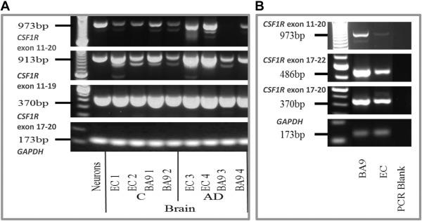 Figure 7: Image of the formation pattern of the CSF1R protein band in the electrophoresis gel.