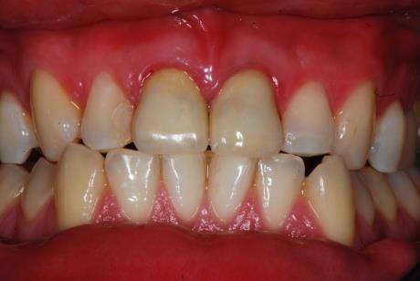Figure 6: A: Post op image.