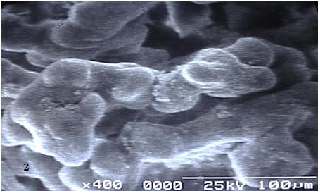 Figure 2: A groups of immature intermediate villi are showing globular extensions of their cell surface.