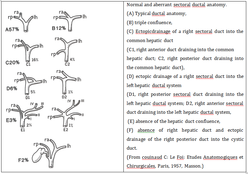 Figure 7: Normal and aberrant sectoral ductal anatomy.