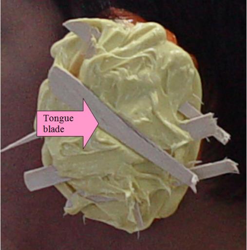 Figure 4: Impression of the area around the implant coping with the wooden pieces as a supported matrix prior to setting.