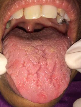 Figure 1: It was non-tender on palpation.