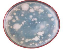Figure 1: Colonies of bacteria from the water sample of Sivagangai Theppakkulam grown on nutrient agar medium.