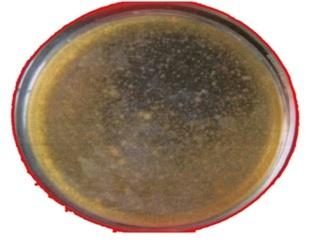 Figure 2: Colonies of coliforms bacteria from the water sample of Sivagangai Theppakkulam and chettiyourani grown on macconky agar medium.