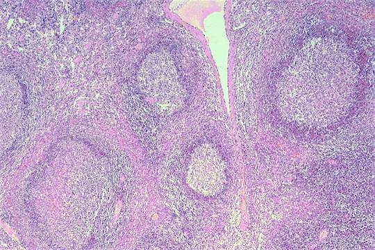 Figure 2: Lymph Node Histology with Germinal Centres and Paracortex.