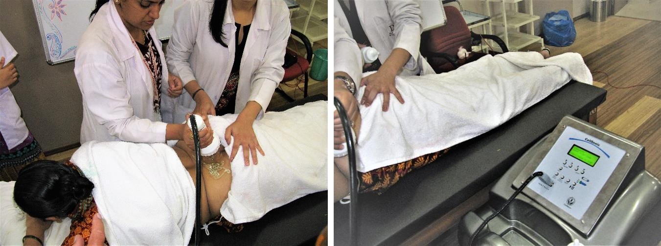Figure 1: Treatment in Progress with CellSonic VIPP.