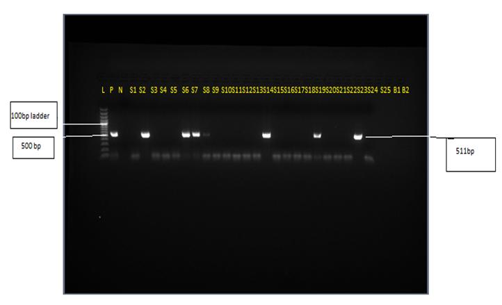 Figure 6: Result of Dengue-specific RT-PCR, showing bands in 1.5% Agarose gel electrophoresis stained with Ethidium bromide. Lane L: 100bp DNA ladder; Lane 2: positive control: Lane 3: negative control; Lanes S2, S6, S7, S14, S19 and S23 are PCR positive samples of patients.