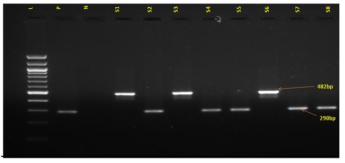 Figure 7: Results of Dengue-specific RT-PCR followed by second-round nested PCR of RNA samples, showing band in 1.5% Agarose gel electrophoresis stained with Ethidium bromide. Lane L: 100bp DNA ladder, Lanes S1, S3, S6 with DEN1 (482bp) and Lanes S2, S4, S5, S7 and S8 with DEN3 (290bp).