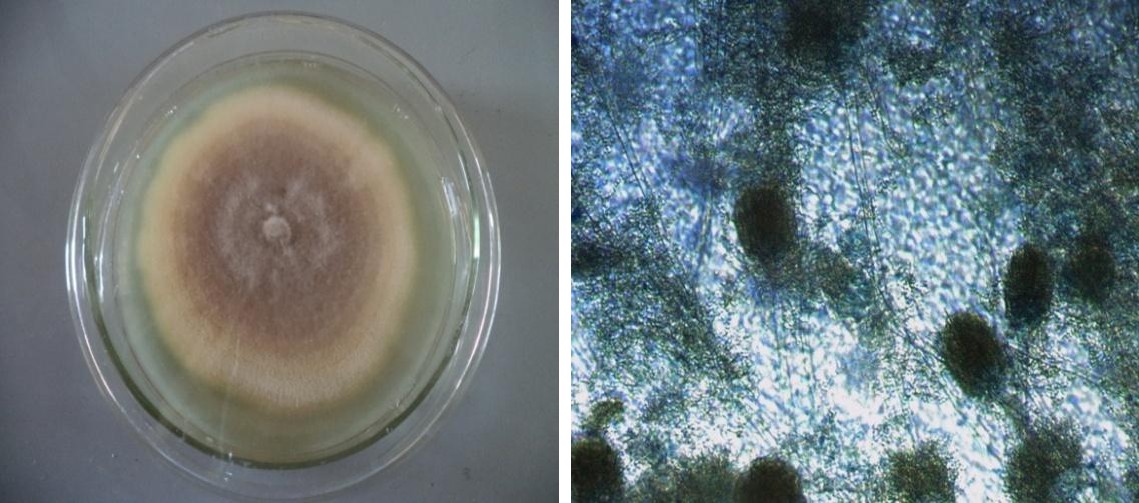 Figure 1: Plate 1). Microscopic examination shows that each conidiophore ended in a terminal enlarged spherical swellings (Figure 1: Plate 2).