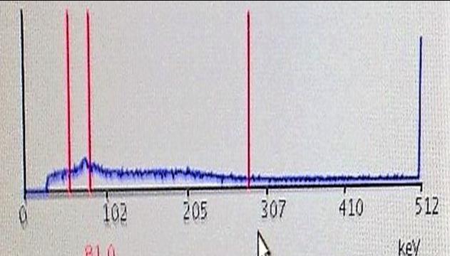 Figure 5: Experimental bremsstrahlung spectrum and energy window set-up for 90Y SPECT scan.