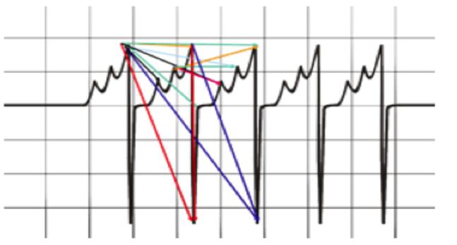 Figure 1: The magnetic field emission modes.