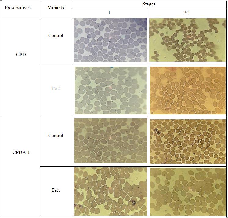 Figure 7: The presence of free Hb in the supernatant (preserving agent CPD). Objective data of free Hb and calculated HCT at the stage VI of the study are presented in Table 5.