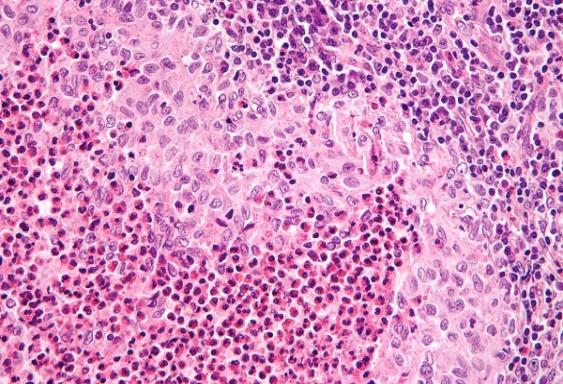 Figure 7: Langerhans cells and melanocytes.