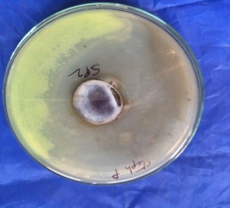 Figure 7: Streptococcusdisc inserted with Ag nanoparticle coated jean cloth.