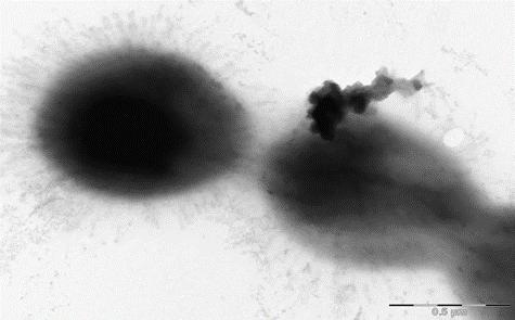 Figure 2: Mechanistic effect of CZNPs on gram-positive MRFs (E. faecium 1449).