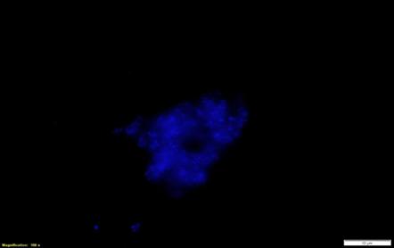 Figure 4: DAPI-fluorescent stain of Enterococcus faecium biofilm formed in 3D scaffold.