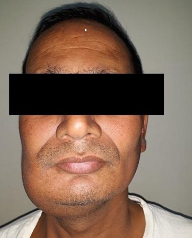 Figure 1: Extraoral photograph.