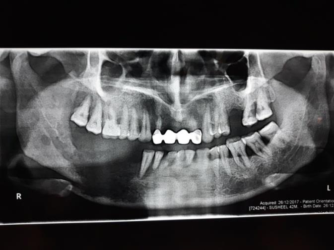 Figure 4: Panoramic image.