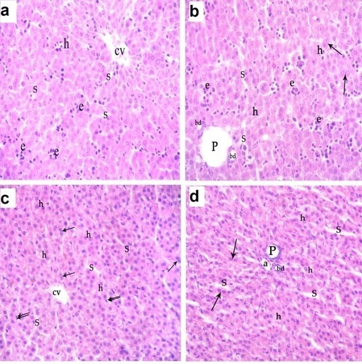 Figure 1: A photomicrograph of a liver section of control groups: (a) D1 showing normal sized central vein (cv), multiple small sized blood sinusoids(s), normal hepatocytes (h) with polygonal large vesicular nuclei and acidophilic cytoplasm. Multiple erythroid islands (e) with intense hyperchromatic nuclei are seen. (b) D1 showing