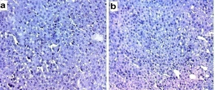 Figure 2: A photomicrograph of a liver section of control groups: (a,b) D1, (c,d) D21 showing few blue colored collagen fibers (bifid tailed arrow) around the central vein (CV), around portal vein (P) (bifid tailed arrow) and also in the lining of blood sinusoid (arrow) (Mallory stain X400). Immunohistochemical Staining for Caspase 3: Liver sections of all control subgroups‘D1 and D21’ showed negative immune reaction for caspase 3in the cytoplasm of hepatocytes (Figure 3).