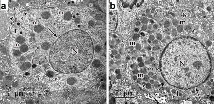 Figure 4: An EM micrograph of a section in the liver of control groups: (a) D1 showing normal hepatocyte with euchromatic nucleus (N) and intact nuclear envelope (arrow). The cytoplasm contains many mitochondria (m), rough endoplasmic reticulum (RER), lipid droplets (L) and glycogen granules (g). Bile canaliculus (bc) with intact microvilli and occluding junctions (head arrow) are seen.(X 10200); (b) D21 showing normal hepatocyte with euchromatic nucleus (n) and intact nuclear envelope (arrow).The cytoplasm contains many mitochondria (m), rough endoplasmic reticulum (RER), lipid droplets (l) and glycogen granules (g). Bile canaliculus (bc) with intact microvilli and occluding junctions (head arrow) are seen (X 13600).